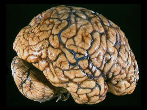 A human brain