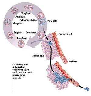 Cancer diagram